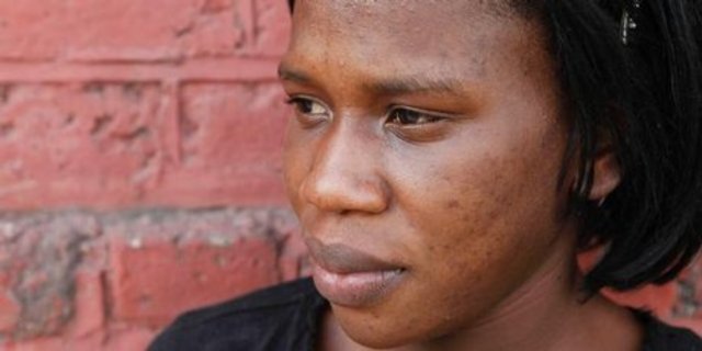 Skin Bleaching a growing problem in Jamaicas Slums