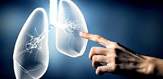 Logros de la epidemiologia-Tabaco asbesto y cáncer de pulmón