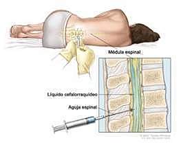 LIQUIDO CEFALORRAQUÍDEO (Galeno)