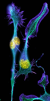 MODERNIDAD- SANTIAGO RAMÓN Y CAJAL (1852-1934)