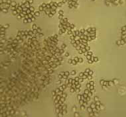 Descubrimiento de las Bacterias