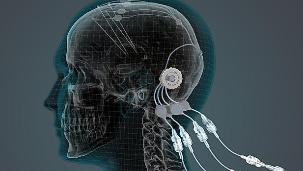 Estimulacion cerebral