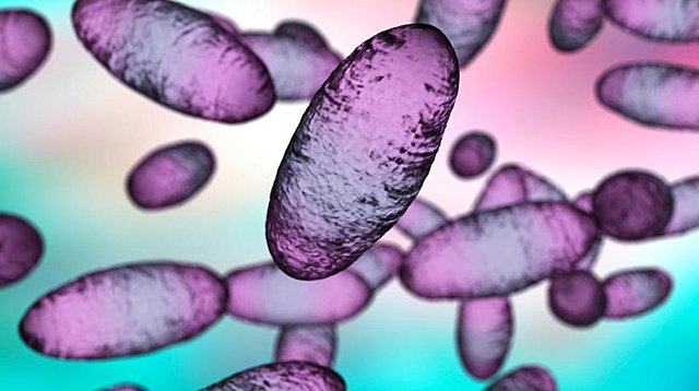 La plaga de justiniano