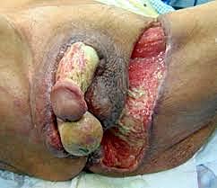 Dr. Alfredo Fournier