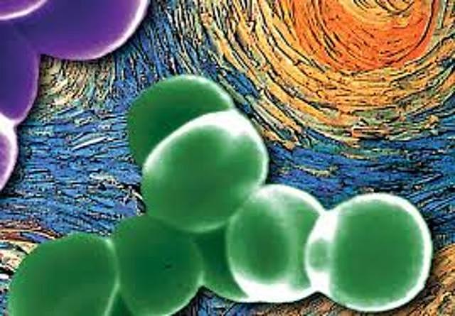 NEUMONIA ATIPICA EN CHINA.