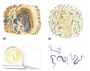 Mycobacterium tuberculosis