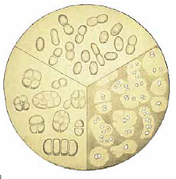 Técnica del cultivo de enriquecimiento