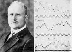 Berger - Electroencefalograma (1924)