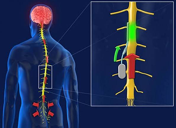 MODELO DE ORGANIZACIÓN JERÁRQUICA (John Hughlings Jackson)