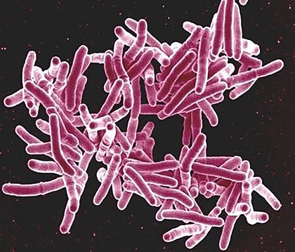 Descubrimiento del Agente Causante de la Tuberculosis
