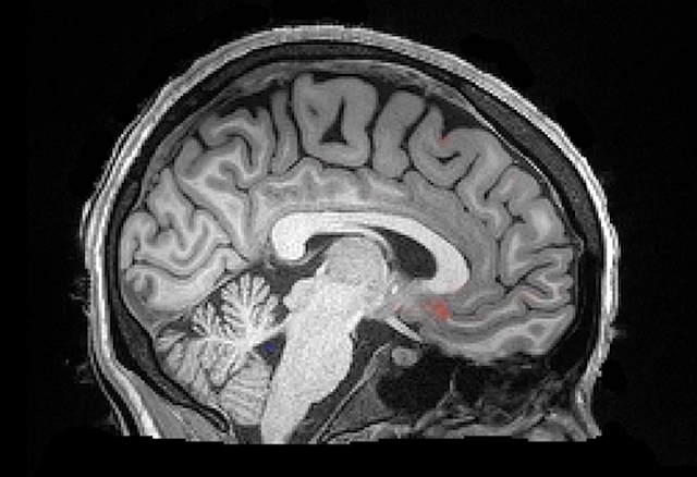 Liquido Cefalorraquídeo: Fuente de procesos mentales.