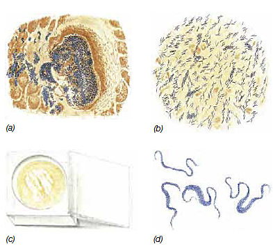 Robert Koch (1843-1910) – DESCUBRIMIENTO DEL AGENTE CAUSANTE DE LA TUBERCULOSIS