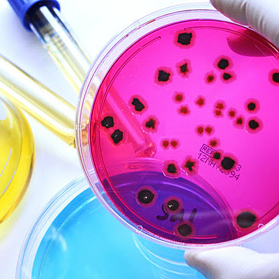 Timeline: El avance de la Microbiologia