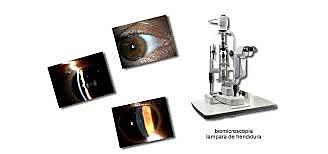 BIOMICROSCOPIO LÁMPARA DE HENDIDURA