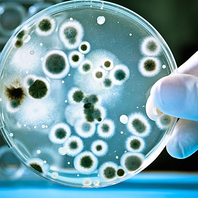 Timeline: La evolucion de la  Microbiologia