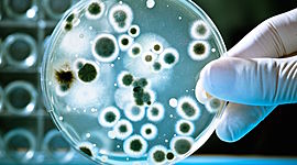 Timeline: La evolucion de la  Microbiologia