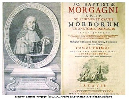 Juan Bautista Morgagni