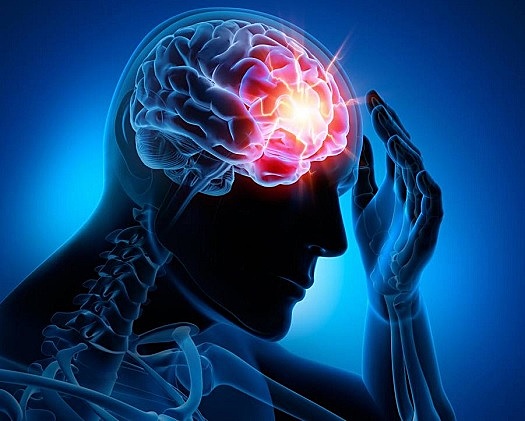 tratamiento epilepsia