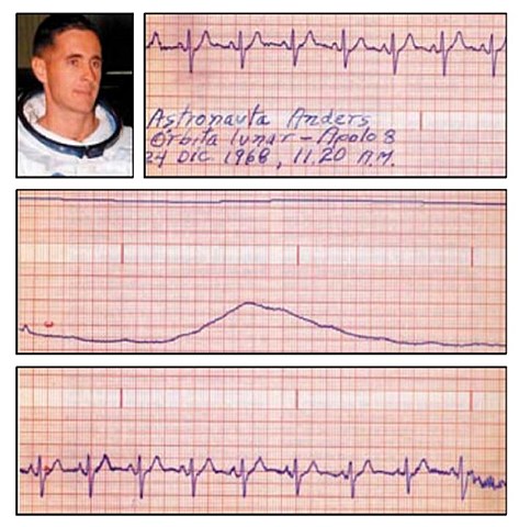1968 Primer  Electrocardiograma Transmitido Lunar a través del espacio