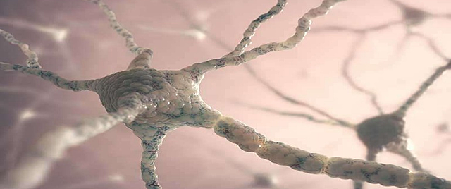 Surgimiento del sistema nervioso