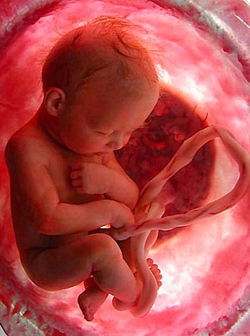 36 semanas de embarazo