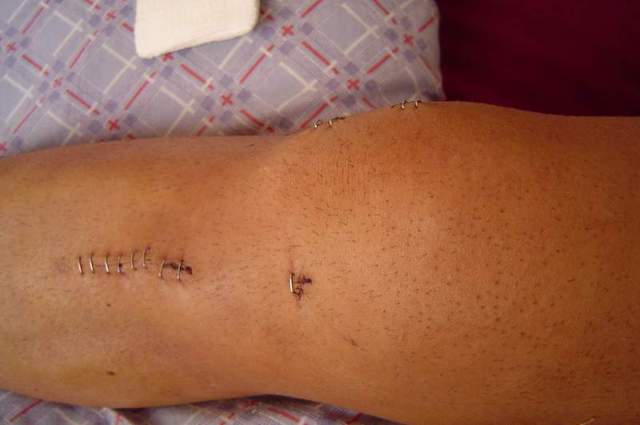 Última visita al Quirófano hasta el momento