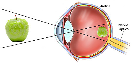 Tesis de la Persistencia Retiniana