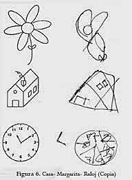 Apraxia Construccional