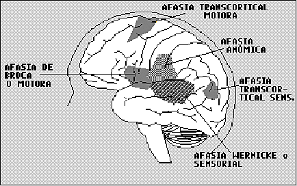 Lordat empleó el término "alalia" a esta alteración designada por Broca como "afemia", y Trousseau desaprobó el término de afemia porque era sinónimo de infamia, y propuso entonces la palabra afasia.