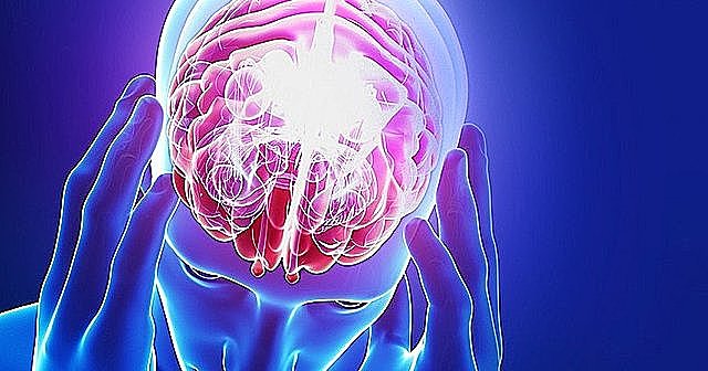 Marie et al., (1922) utilizaron el término planotopoquinesia.