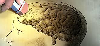 Trastornos Cognitivos