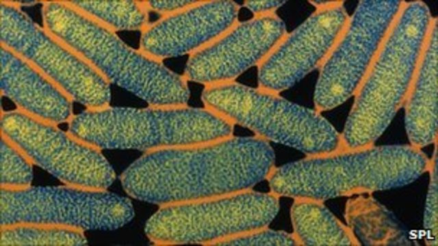 Legoinnaire's Disease Source Identified