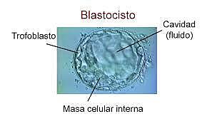 Blastocisto