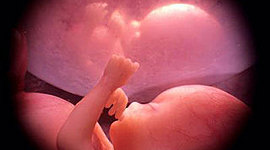 Timeline: DESARROLLO PRENATAL,