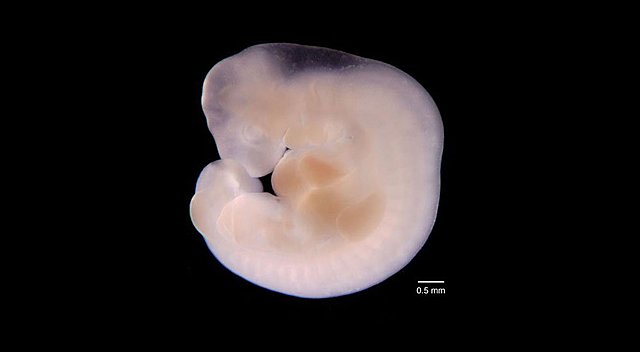 Principales Cambios del Desarrollo Prenatal 01