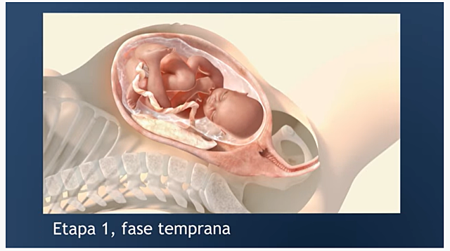 El trabajo de parto / Nacimiento