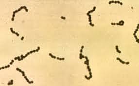 Streptococcus