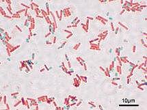 BACILLUS SUBTILIS puede producir dos esporas en la misma célula madre