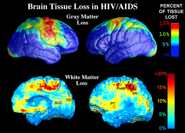 A name for the Disease.
