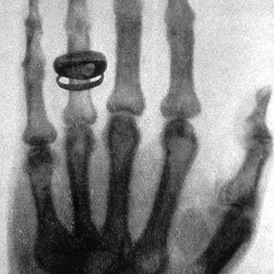 Timeline: Historia de los rayos x