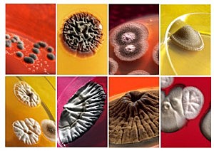 DESARROLLAN TARJETA DETECTORA DE MICROBIOS Y BATERIAS: SE PODRA USAR EN HOSPITALES Y RESTAURANTES