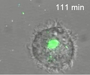 CAPTAN EN VIVO COMO EL SIDA (VIH) CREA UN CABALLO DE TROYA PARA INFECTAR RAPIDAMENTE UN ORGANISMO