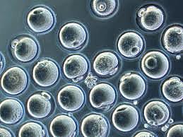 Óvulos de células madre