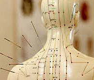 Medicina Tradicional China (Acupuntura) año 300-400