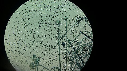 Hechos importantes de la Fitopatologia