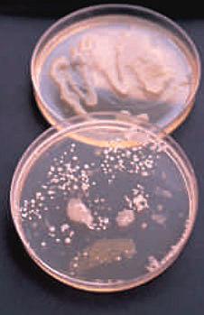 Hechos importantes de la Fitopatologia