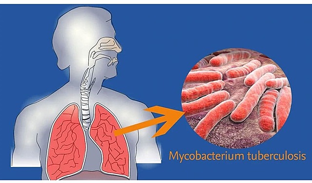 Hechos importantes de la Fitopatologia