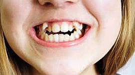 Timeline: Historia de la Ortodoncia