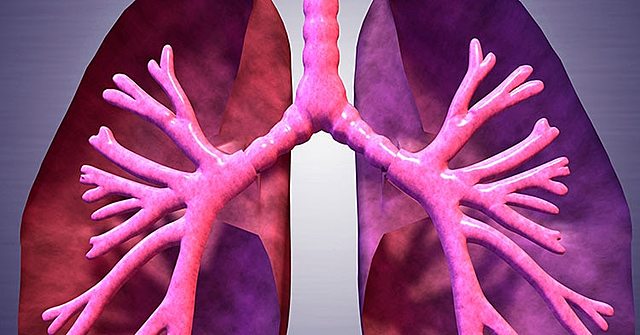 ENFERMEDAD DE LOS LEGIONARIOS