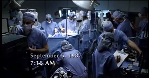 Operación de los siameses